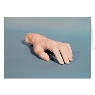 Eine Form der Hand von Frederic Chopin