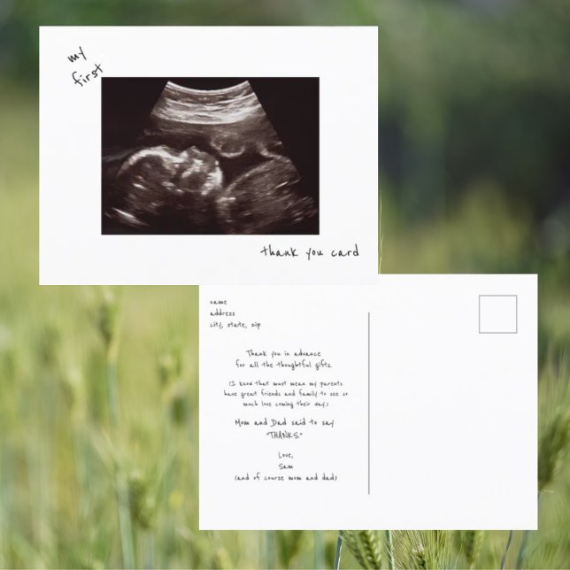 Einfache Funny Ultrasound Baby Dusche Vielen Dank Postkarte (Von Creator hochgeladen)