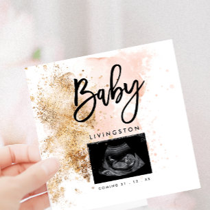 Einzigartiges Sonogramm kommt bald zur neuen Baby- Ankündigung