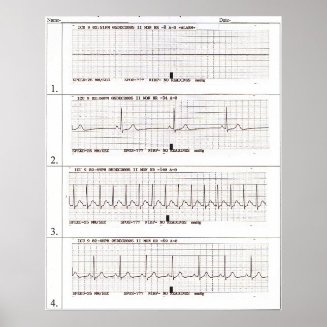 ekg Rhythms Poster (Vorne)