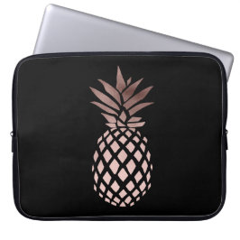 elegantes klares Imitat-Rosen-Goldtropische Ananas Laptopschutzhülle