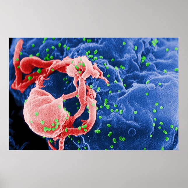 Elektronenmikrograph des HIV-1-Budgetlymphsystems Poster (Vorne)