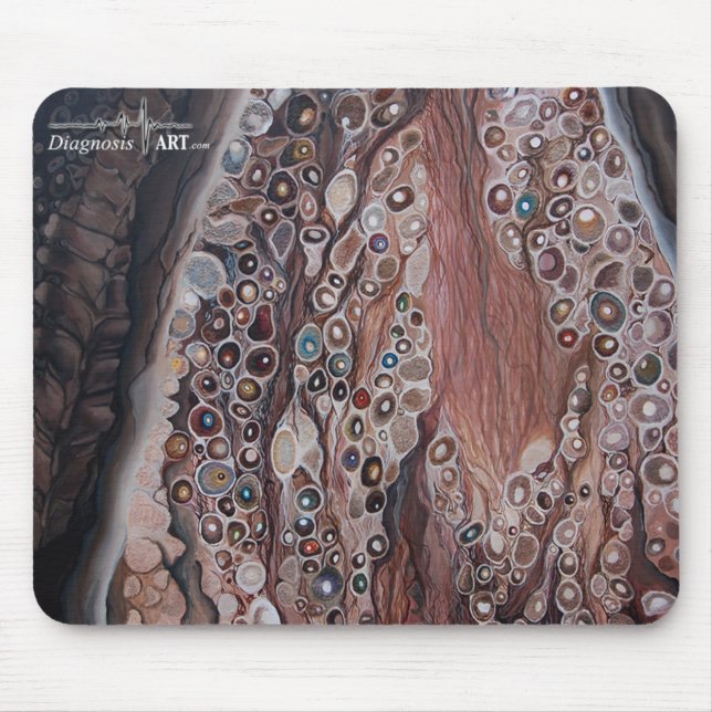 "Empfindung: Dorsale Wurzel-Knotenpunkt " Mousepad (Vorne)