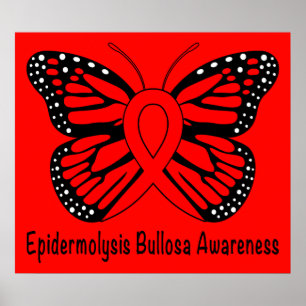 Epidermolysis Bullosa (EB) Poster