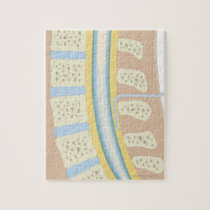 Epidurale Anästhesie Puzzle