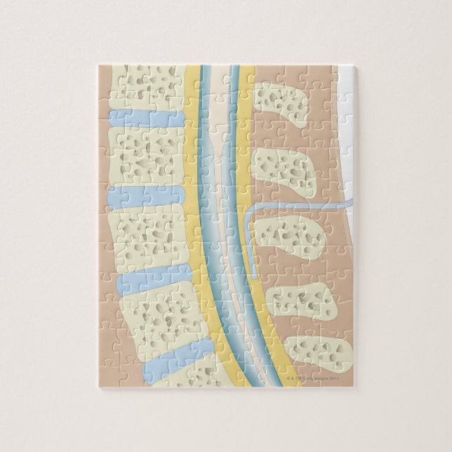 Epidurale Anästhesie Puzzle (Vertikal)