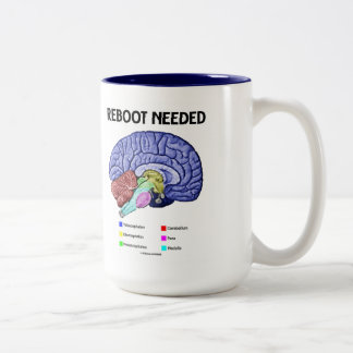 Erforderlicher Neustart (anatomischer Spaß des Geh Zweifarbige Tasse