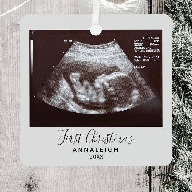 Erste Weihnachtsschwangerschaft Ultrasound Ankündi Ornament Aus Metall (First Christmas Sonogram Metal Ornament)