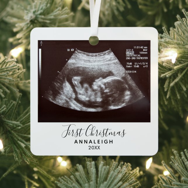 Erste Weihnachtsschwangerschaft Ultrasound Foto Ur Ornament Aus Metall (InSitu)