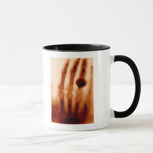 Erste X-Ray, 1901, Fotografie Tasse (Rechts)