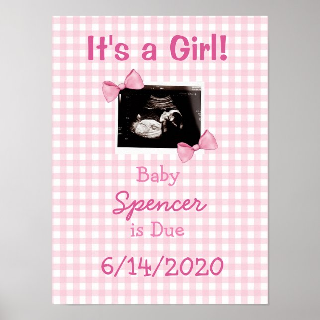 Es ist ein Girl, Ultrasound Baby Announcement Post Poster (Vorne)