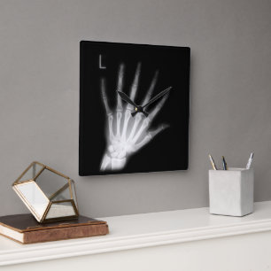 Extra-Digit Röntgenbild linker Hand Quadratische Wanduhr