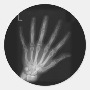 Extra Digit X-ray Left Hand Runder Aufkleber