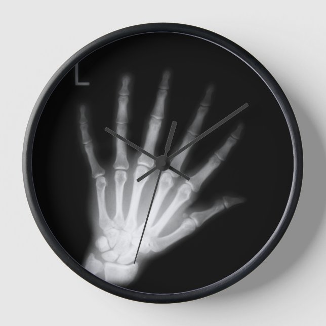 Extra Digit X-ray Left Hand Uhr (Vorderseite)