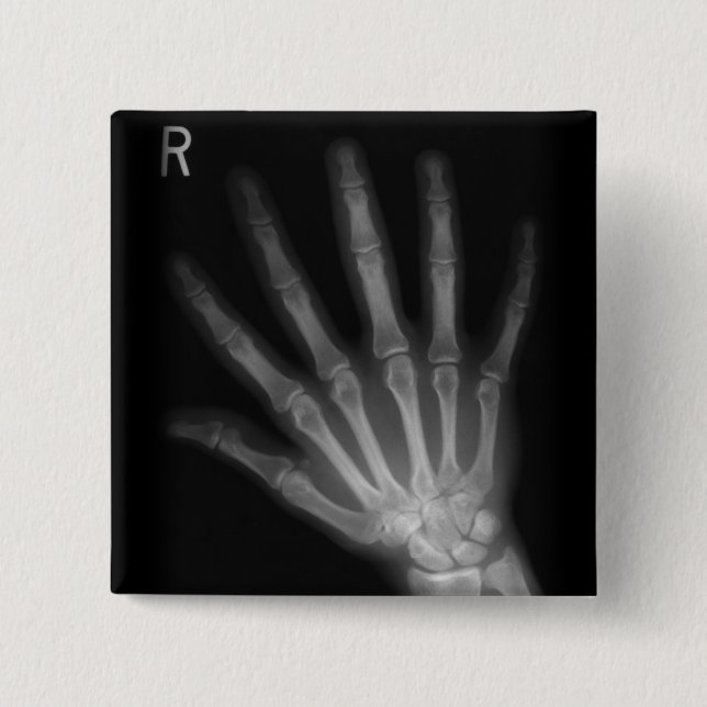 Extra Digit X-ray Right Hand Button (Vorderseite)