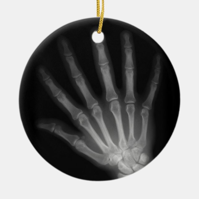 Extra Digit X-ray Right Hand Keramikornament (Vorne)