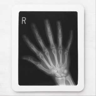 Extra Digit X-ray Right Hand Mousepad