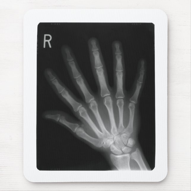Extra Digit X-ray Right Hand Mousepad (Vorne)