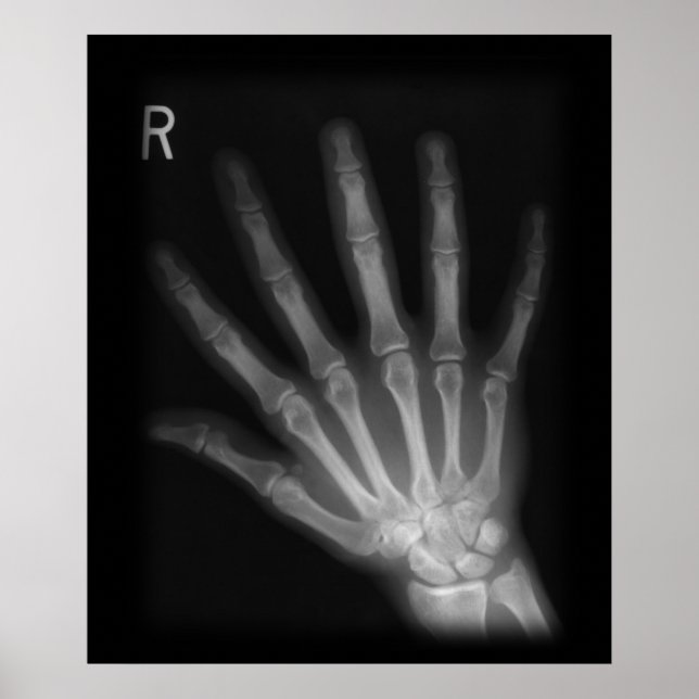 Extra Digit X-ray Right Hand Poster (Vorne)