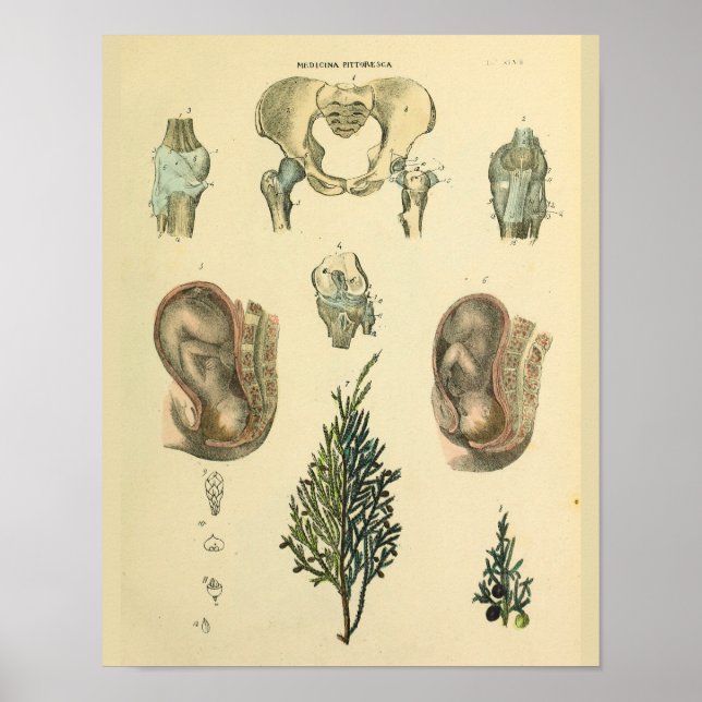 Fetalposition Pelvis Anatomie Vintage Kunstdrucken Poster (Vorne)