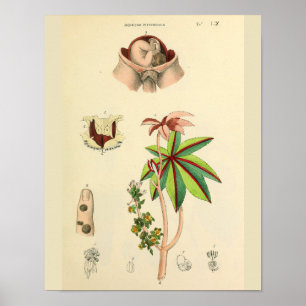 Fetus Position Uterus Vintage Anatomie Art Print Poster