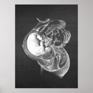 Fetus Womb Anatomy Obstetrics Deco Nr. 2 Poster