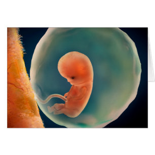 Fetusentwicklung nach 9 Wochen