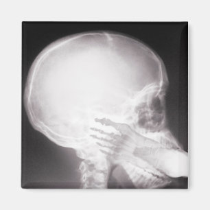 Foot in Mouth X-Ray Magnet