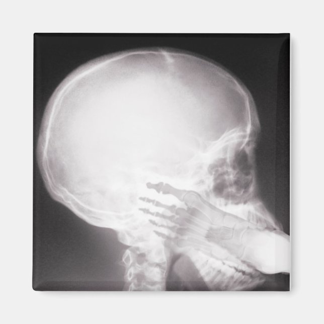 Foot in Mouth X-Ray Magnet (Vorne)