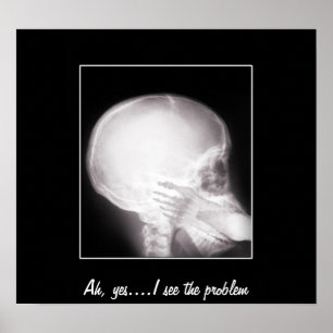 Foot in Mouth X-Ray Poster
