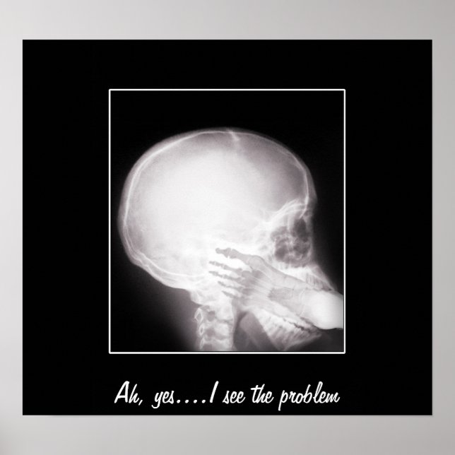 Foot in Mouth X-Ray Poster (Vorne)
