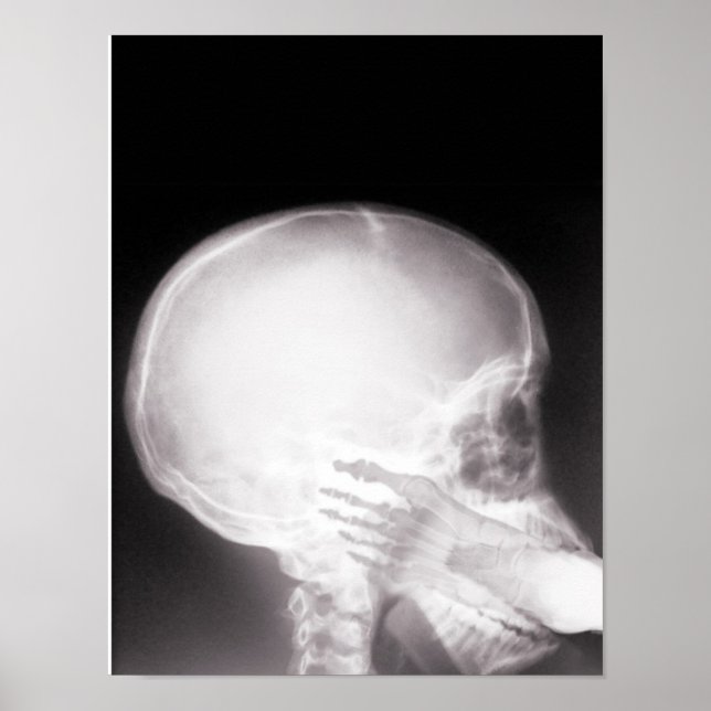 Foot in Mouth X-Ray Poster (Vorne)