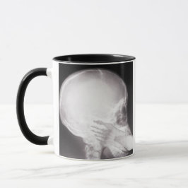 Foot in Mouth X-Ray Tasse