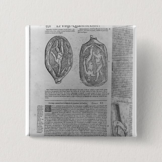 Fötus, Illustration 'von den Gesamtwerken Button (Vorderseite)