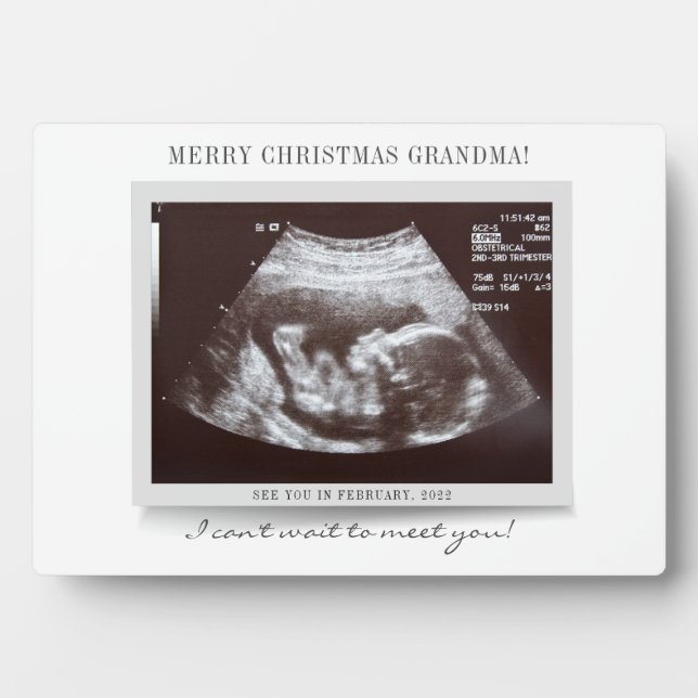 Frohe Weihnachten Oma Baby Reveal Scan Fotoplatte (Vorderseite)