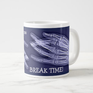 Funny Broken Finger Xray "Break Time" Jumbo-Tasse