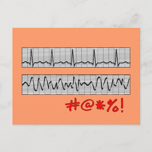 Funny Cardiac Rhythm Strip Geschenke Postkarte (Vorderseite)