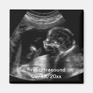 Für Neugeborene: First Ultrasound Sonogram Baby Magnet