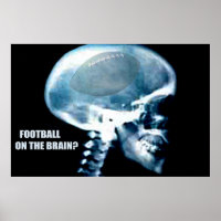 Fußballkopf (Röntgen)