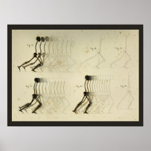 Gangbildanalyse Bein Wirbelsäule Chiropraktik-Diag Poster