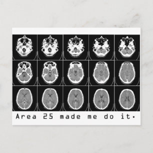 Gebiet 25 hat mich dazu gebracht, es zu tun. postkarte