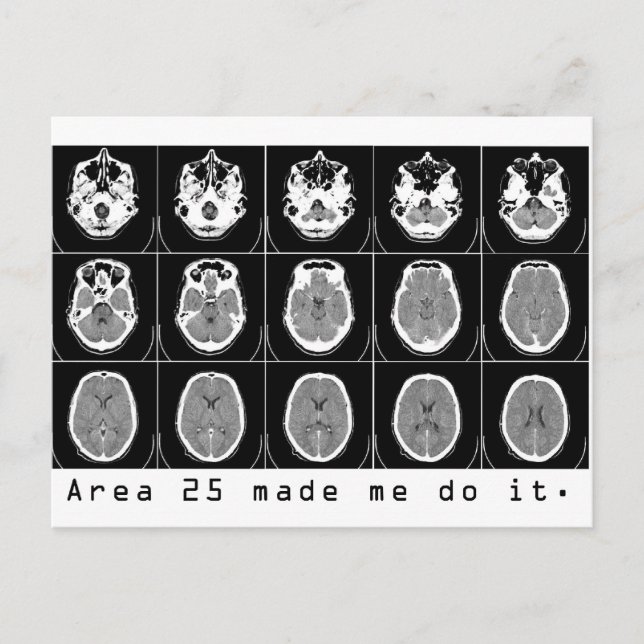 Gebiet 25 hat mich dazu gebracht, es zu tun. postkarte (Vorderseite)