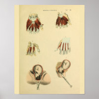 Geburtszange Geburtshilfe Anatomie Medizin Kunst D