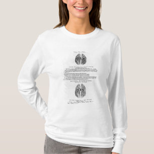 Gefäßsystem des Gehirns T-Shirt