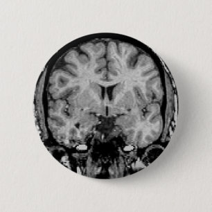 Gehirn MRI, Kranzscheibe Button