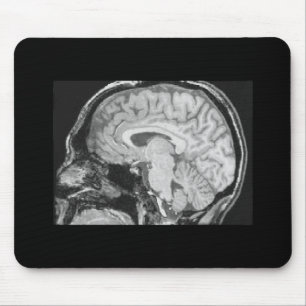 Gehirn MRI Mousepad