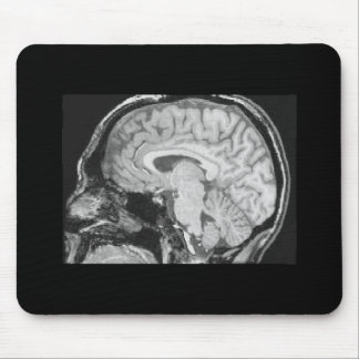 Gehirn MRI Mousepad