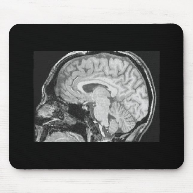 Gehirn MRI Mousepad (Vorne)
