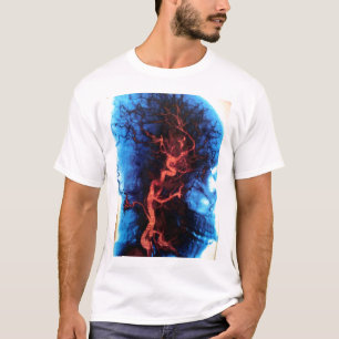 Gehirn-Scan T-Shirt