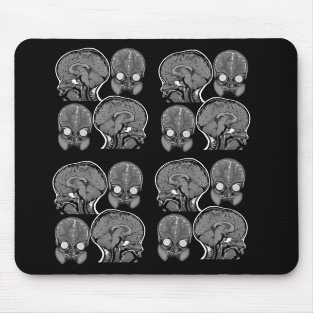 GEHIRNE! (MRI) MOUSEPAD (Vorne)